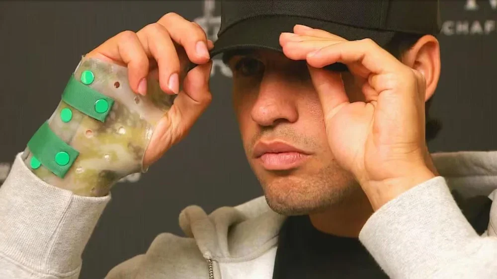 Alcaraz con la protección en su muñeca